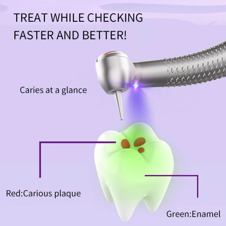 YAYIDA Dental alta velocidad LED botón pulsador pieza de mano detección de caries pieza de mano con generador